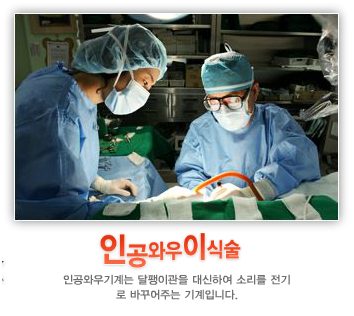 인공와우